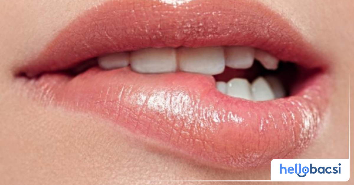 Liệu mụn herpes ở miệng có thể tự khỏi mà không cần điều trị?
