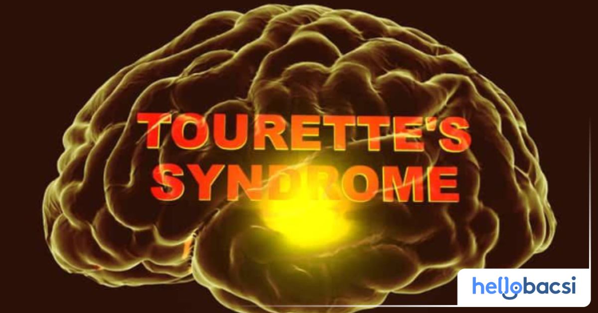 Đặc điểm chung của hội chứng Tourette là gì?
